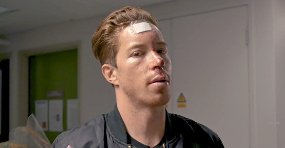 ShaunWhite-2-1080x560